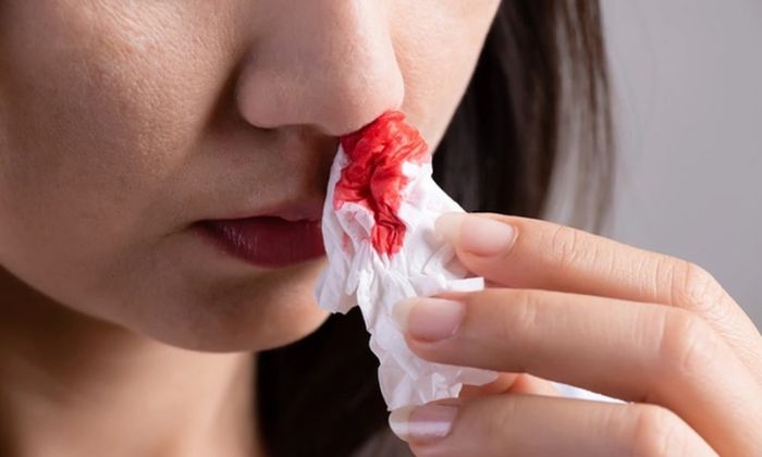 Giải thích giấc mơ chảy máu theo y học