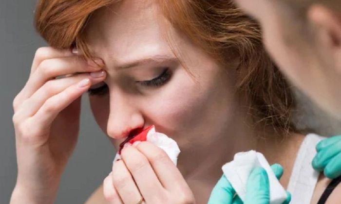 Mơ bị đánh chảy máu mũi