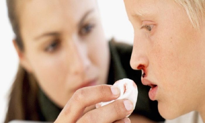 Mơ thấy bạn bè chảy máu mũi