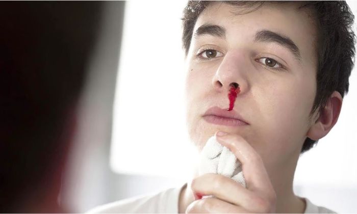 Nằm mơ thấy chảy máu mũi đánh con gì? Mẹo chọn số chuẩn 100%